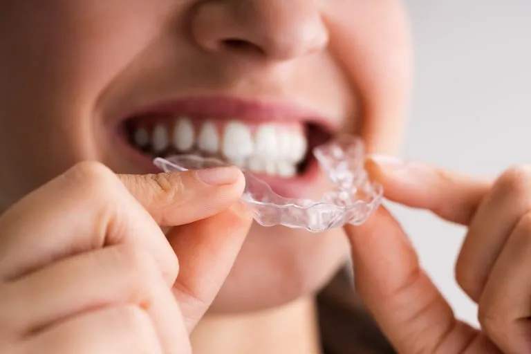 Why Invisalign is the Top Choice for a Perfect Smile in Denver, CO